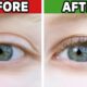 Natural Eyelash Growth Remedies