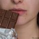 Chocolate Really Causing Your Pimples