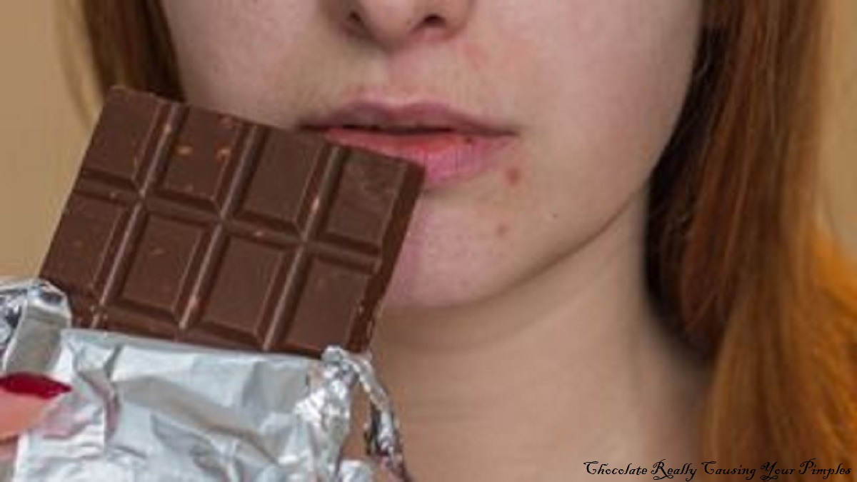 Chocolate Really Causing Your Pimples