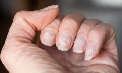 Do Press on Nails Ruin your Natural Nails?