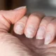 Do Press on Nails Ruin your Natural Nails?