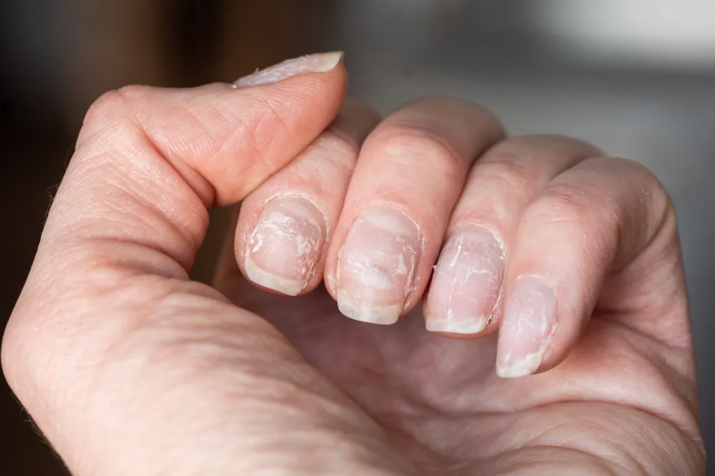 Do Press on Nails Ruin your Natural Nails?